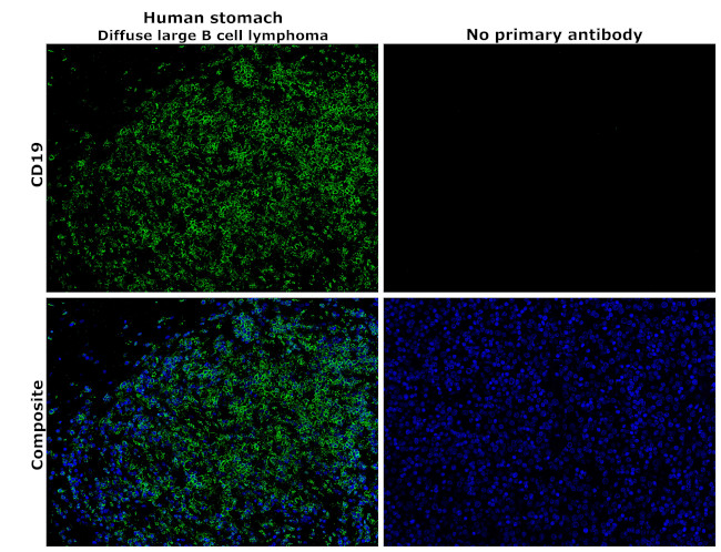 CD19 Antibody in Immunohistochemistry (Paraffin) (IHC (P))