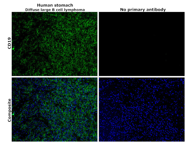 CD19 Antibody in Immunohistochemistry (Paraffin) (IHC (P))