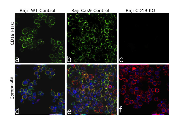 CD19 Antibody in Immunocytochemistry (ICC/IF)