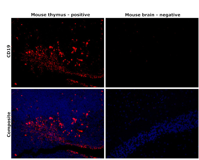 CD19 Antibody in Immunohistochemistry (Paraffin) (IHC (P))