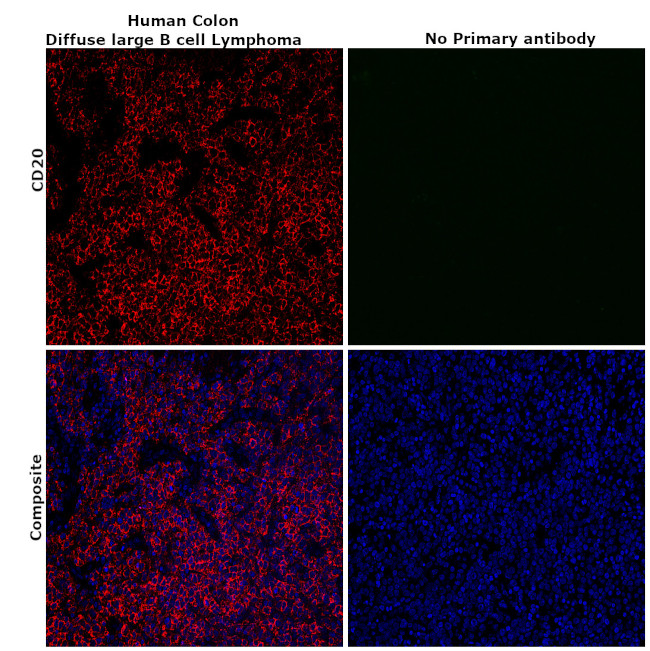 CD20 Antibody in Immunohistochemistry (Paraffin) (IHC (P))