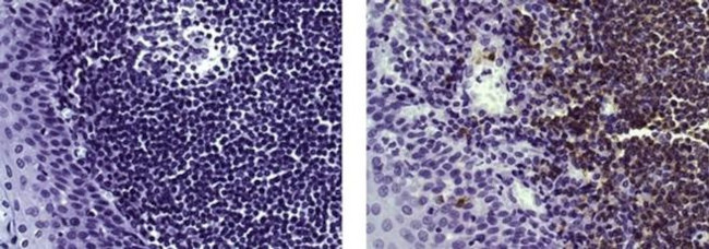 CD20 Antibody in Immunohistochemistry (Paraffin) (IHC (P))