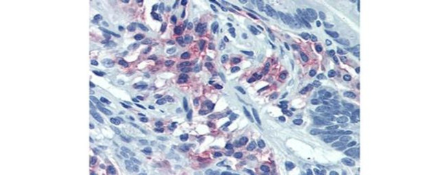 CD38 Antibody in Immunohistochemistry (Paraffin) (IHC (P))