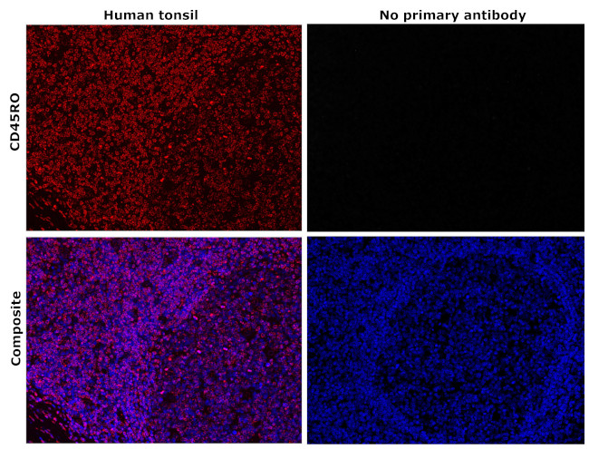 CD45RO Antibody in Immunohistochemistry (Paraffin) (IHC (P))