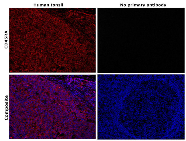 CD45RA Antibody in Immunohistochemistry (Paraffin) (IHC (P))