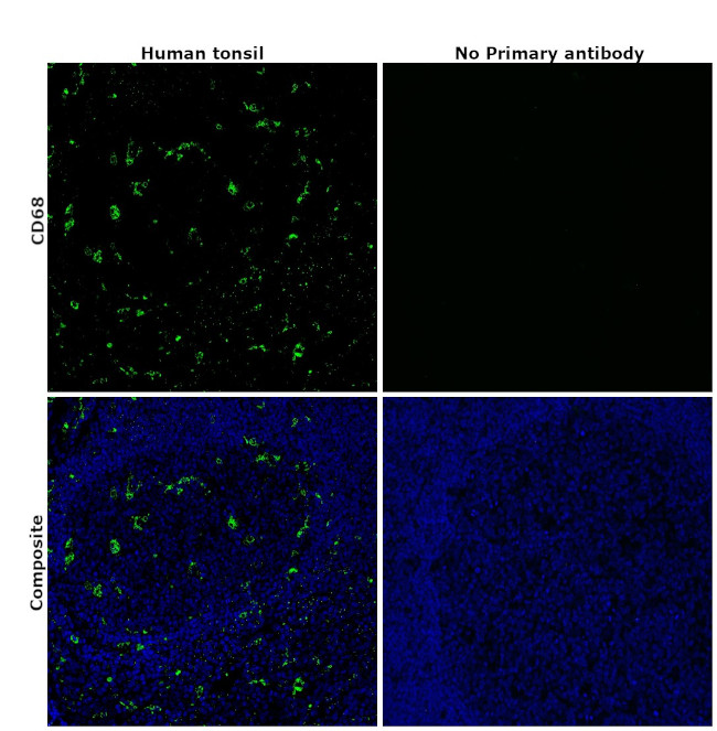 CD68 Antibody in Immunohistochemistry (Paraffin) (IHC (P))