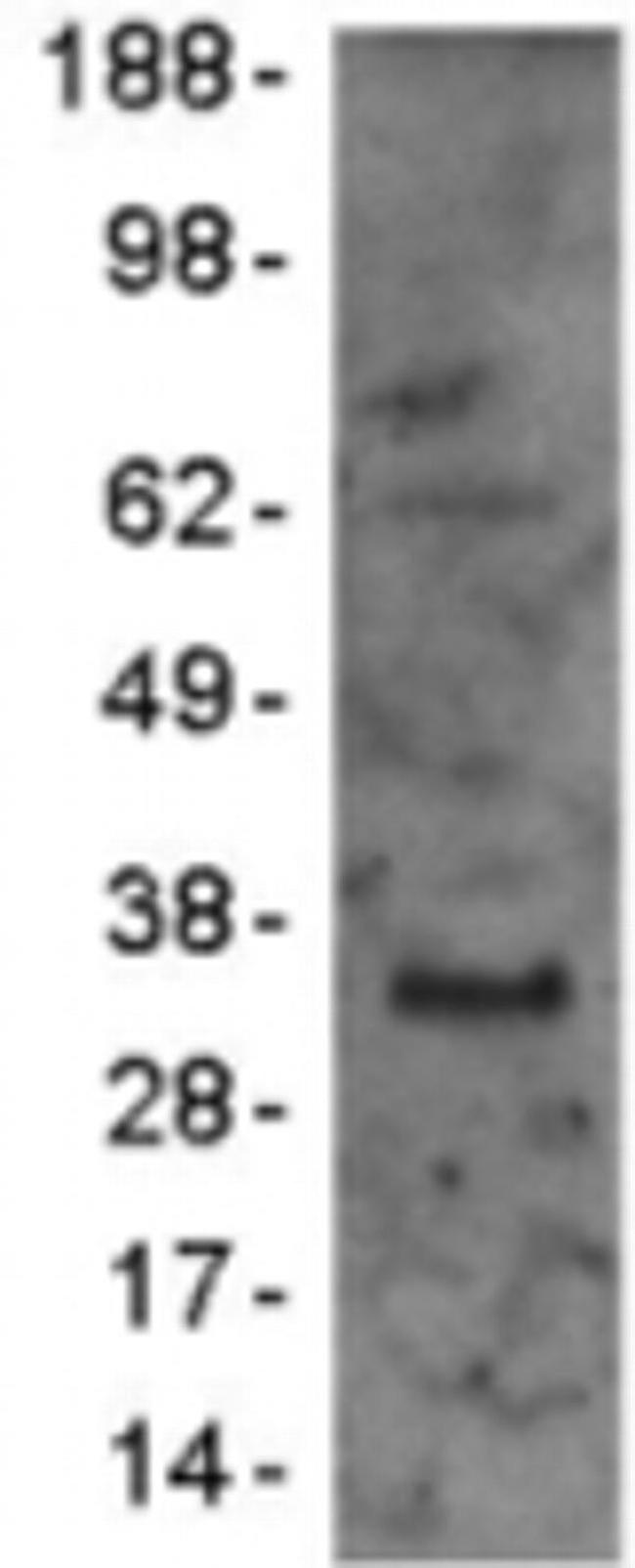 CD79a Antibody in Western Blot (WB)