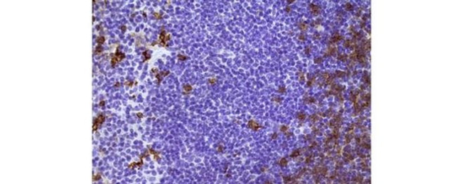 CD8a Antibody in Immunohistochemistry (Paraffin) (IHC (P))