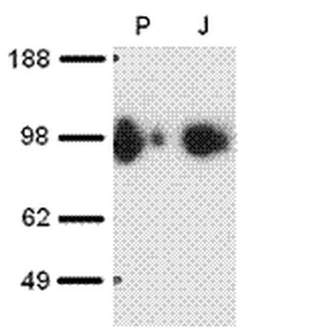 CD107b (LAMP-2) Antibody in Western Blot (WB)