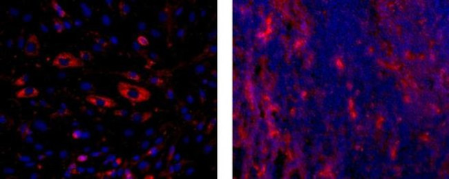 CD141 Antibody in Immunocytochemistry (ICC/IF)