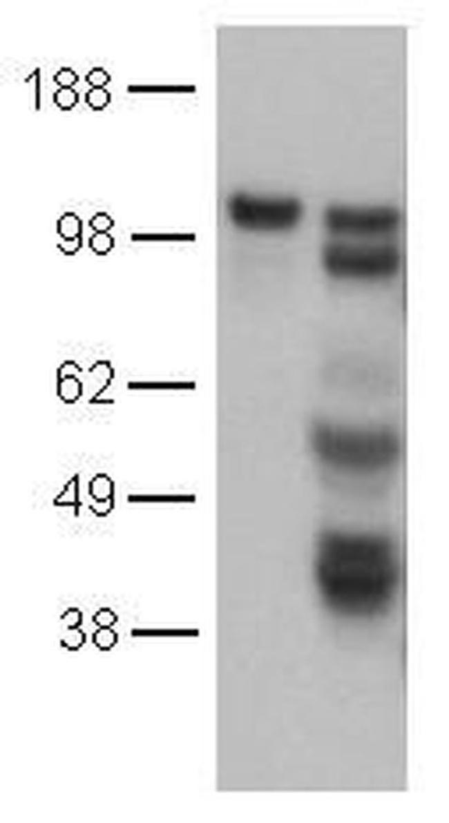 CD144 (VE-cadherin) Antibody in Western Blot (WB)