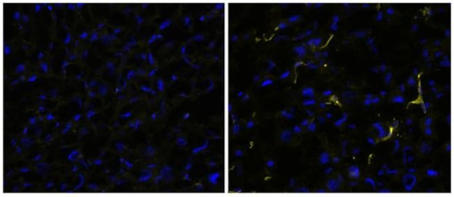 CD163 Antibody in Immunohistochemistry (Frozen) (IHC (F))