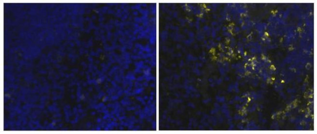 CD163 Antibody in Immunohistochemistry (Frozen) (IHC (F))