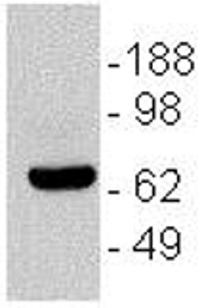 CD196 (CCR6) Antibody in Western Blot (WB)