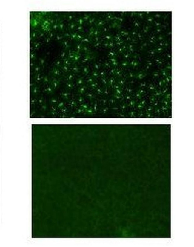 CD207 (Langerin) Antibody in Immunohistochemistry (IHC)