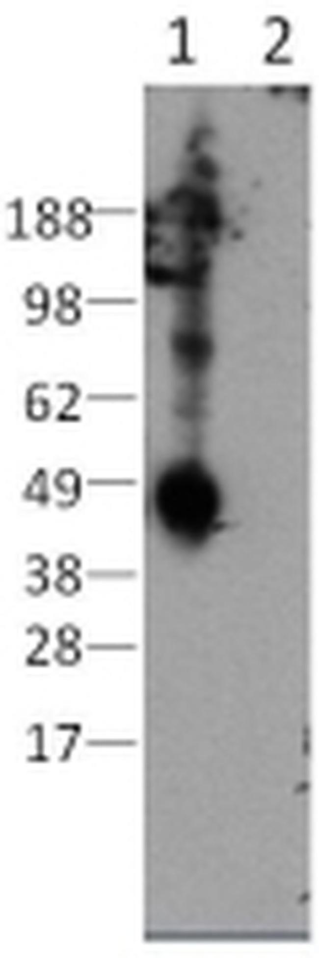 CD207 (Langerin) Antibody in Western Blot (WB)