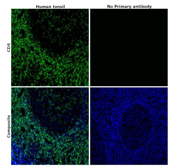 CD4 Antibody in Immunohistochemistry (Paraffin) (IHC (P))