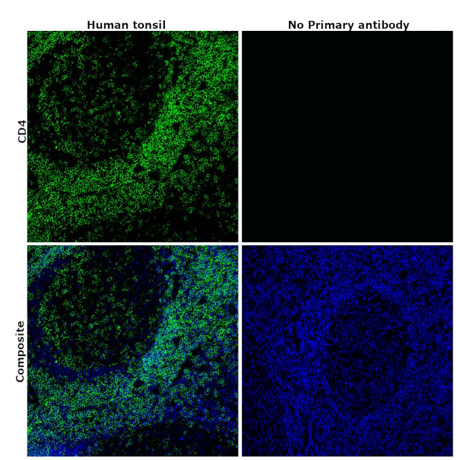 CD4 Antibody in Immunohistochemistry (Paraffin) (IHC (P))