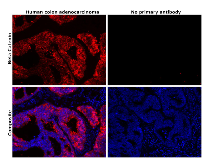 beta Catenin Antibody in Immunohistochemistry (Paraffin) (IHC (P))