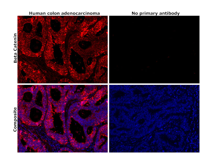 beta Catenin Antibody in Immunohistochemistry (Paraffin) (IHC (P))