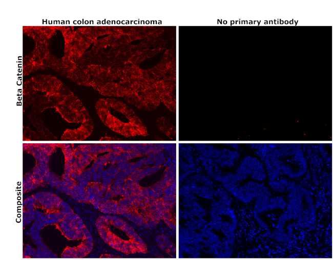 beta Catenin Antibody in Immunohistochemistry (Paraffin) (IHC (P))