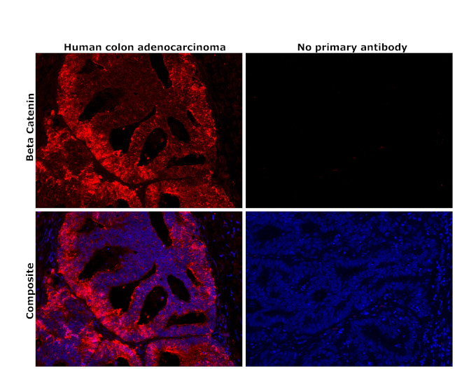 beta Catenin Antibody in Immunohistochemistry (Paraffin) (IHC (P))