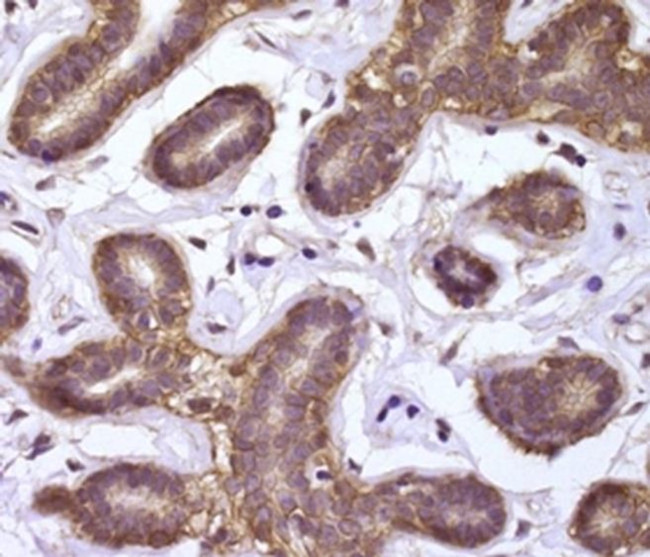 beta Catenin Antibody in Immunohistochemistry (Paraffin) (IHC (P))