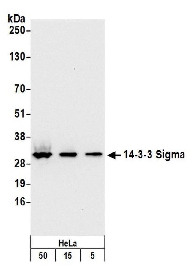 14-3-3 Sigma Antibody in Western Blot (WB)