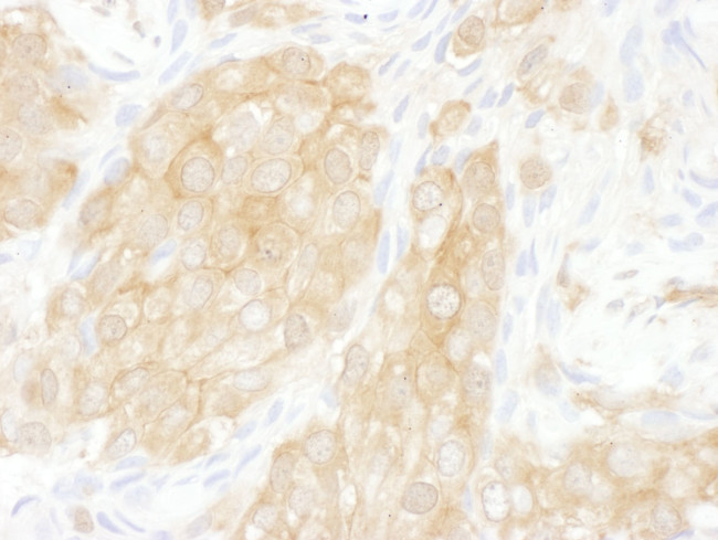 14-3-3 theta Antibody in Immunohistochemistry (IHC)