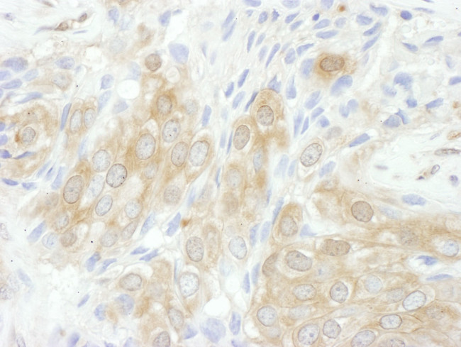 14-3-3 theta Antibody in Immunohistochemistry (IHC)