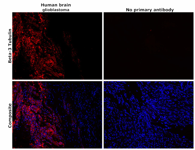 beta-3 Tubulin Antibody in Immunohistochemistry (Paraffin) (IHC (P))