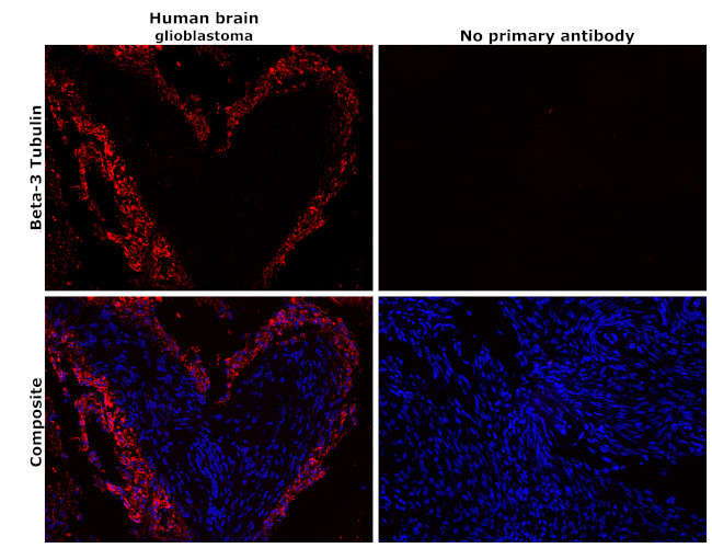 beta-3 Tubulin Antibody in Immunohistochemistry (Paraffin) (IHC (P))