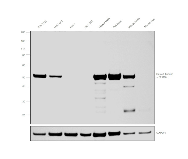 beta-3 Tubulin Antibody in Western Blot (WB)