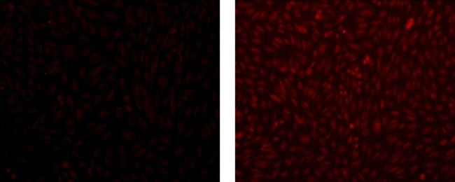 Mouse IgG1 kappa Isotype Control in Immunocytochemistry (ICC/IF)