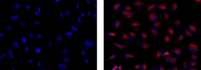 Mouse IgG1 kappa Isotype Control in Immunocytochemistry (ICC/IF)