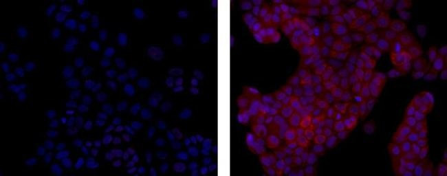 Mouse IgG1 kappa Isotype Control in Immunocytochemistry (ICC/IF)