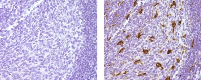 Mouse IgG1 kappa Isotype Control in Immunohistochemistry (Paraffin) (IHC (P))