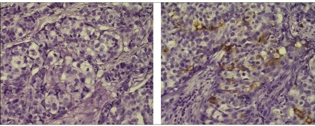 Mouse IgG1 kappa Isotype Control in Immunohistochemistry (Paraffin) (IHC (P))