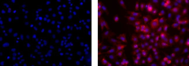 Mouse IgG2a kappa Isotype Control in Immunocytochemistry (ICC/IF)