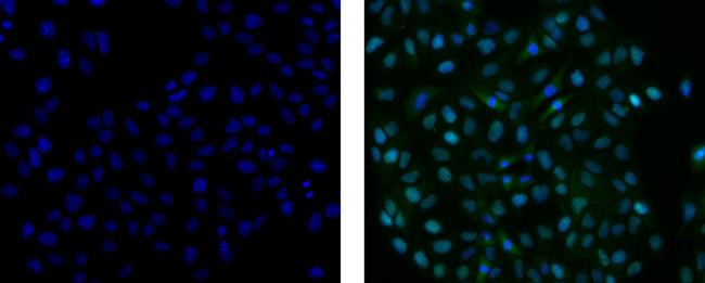 Mouse IgG2a kappa Isotype Control in Immunocytochemistry (ICC/IF)