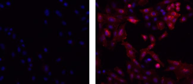 Mouse IgG2b kappa Isotype Control in Immunocytochemistry (ICC/IF)