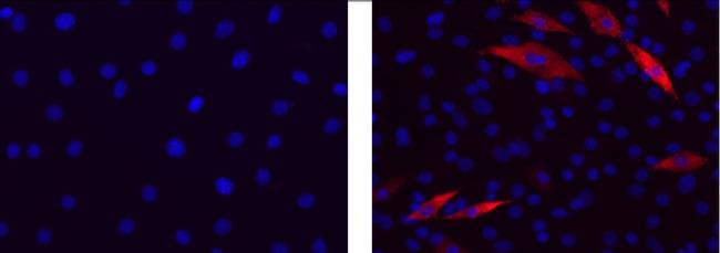 Mouse IgG2b kappa Isotype Control in Immunocytochemistry (ICC/IF)