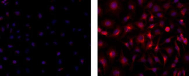 Mouse IgG2b kappa Isotype Control in Immunocytochemistry (ICC/IF)