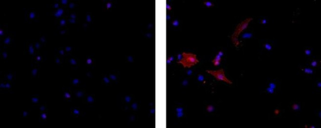 Mouse IgG3 Isotype Control in Immunocytochemistry (ICC/IF)