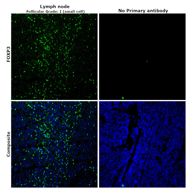 FOXP3 Antibody in Immunohistochemistry (Paraffin) (IHC (P))