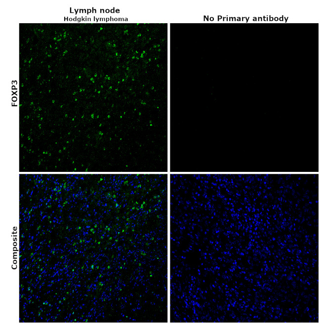 FOXP3 Antibody in Immunohistochemistry (Paraffin) (IHC (P))