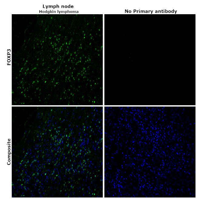 FOXP3 Antibody in Immunohistochemistry (Paraffin) (IHC (P))