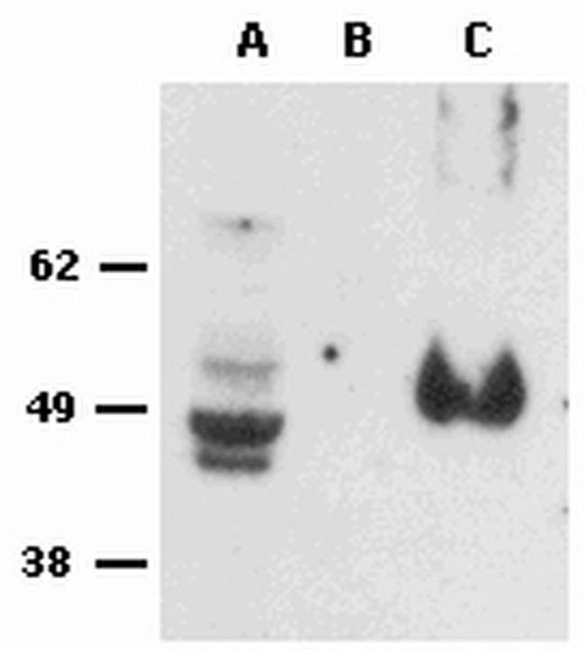 FOXP3 Antibody in Western Blot (WB)