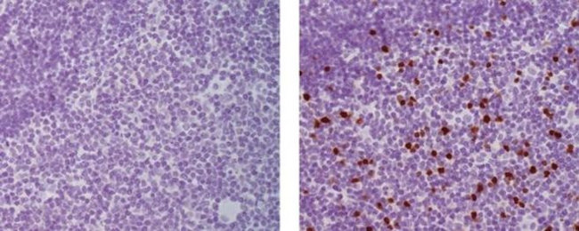 EOMES Antibody in Immunohistochemistry (Paraffin) (IHC (P))