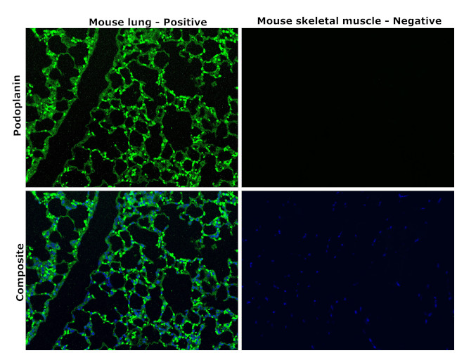 Podoplanin Antibody in Immunohistochemistry (Paraffin) (IHC (P))